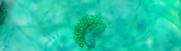 sporangium of the common mold rhizopus